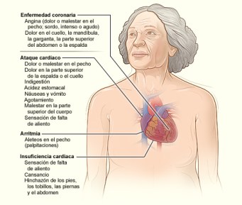 signos-y-sintomas-de-enfermedades-cardiovasculares
